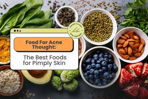 Food For Acne Thought: The Best Foods for Pimply Skin - Tuco Kids