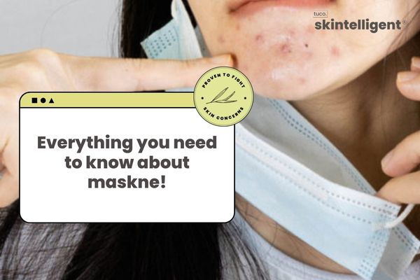 How to prevent Maskne - Tuco Kids
