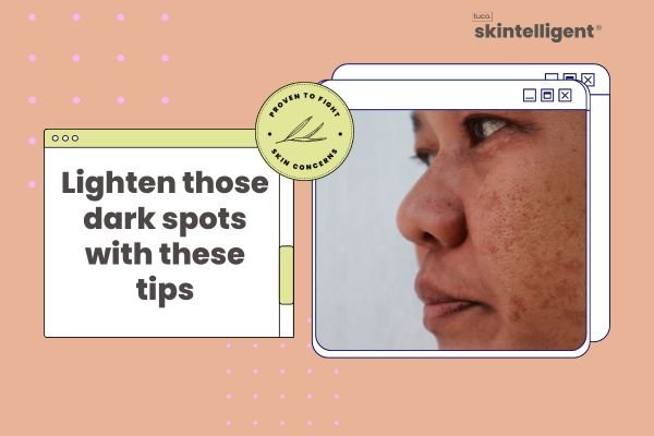 Ingredient That Treats Stubborn Dark Spots - Tuco Kids