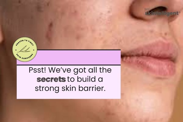 Skin barrier: Secret strength of skin - Tuco Kids
