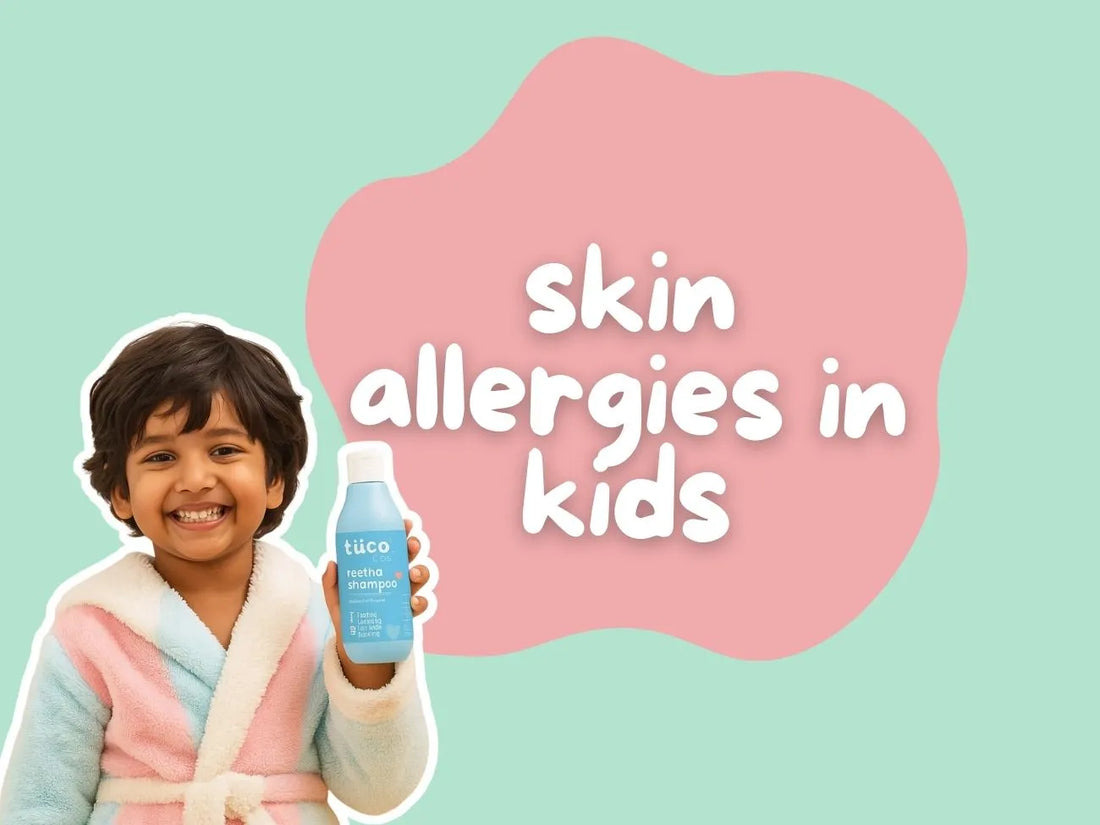 Child Skin Allergy Treatment at Home: Safe and Effective Remedies Every Parent Can Try