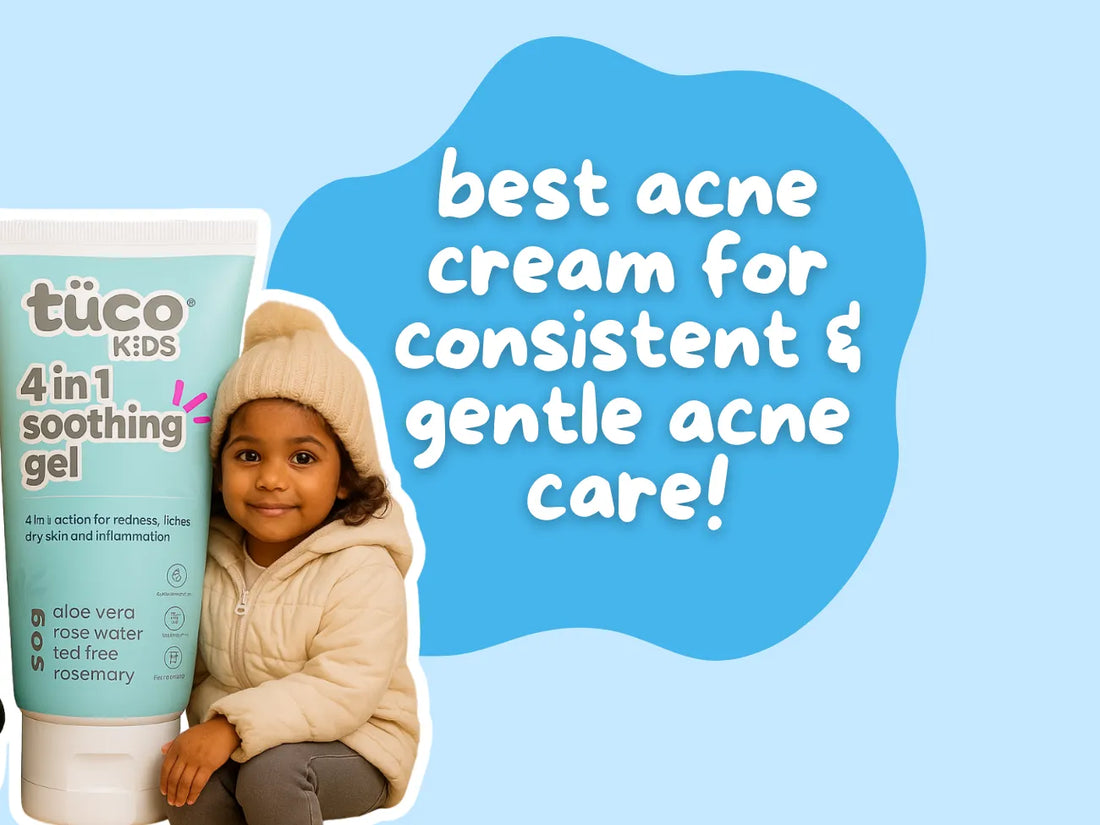 Best Acne Cream for Gentle and Consistent Acne Care in Kids