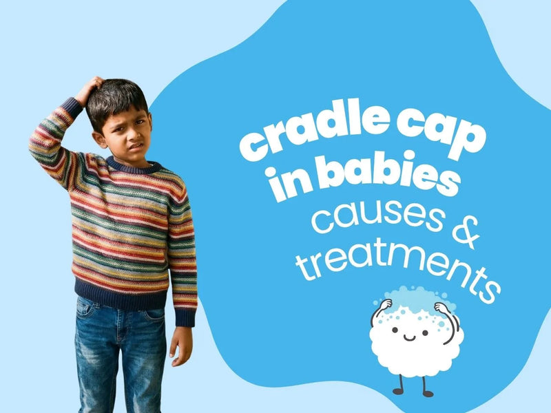 Cradle Cap in Babies: Causes, Treatment & Best Products