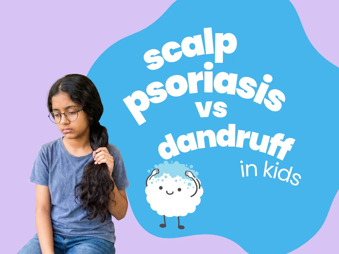 Scalp Psoriasis vs Dandruff in Kids: Symptoms & Home Remedies