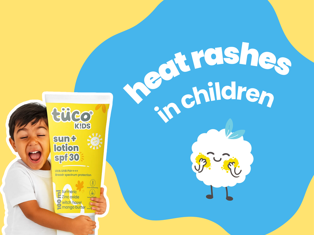 Heat Rashes in Children: Causes & Remedies