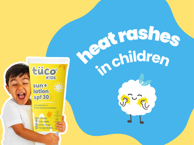 Heat Rashes in Children: Causes & Remedies
