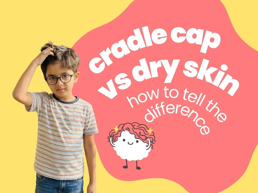 Cradle Cap vs Dry Skin: How to Tell the Difference