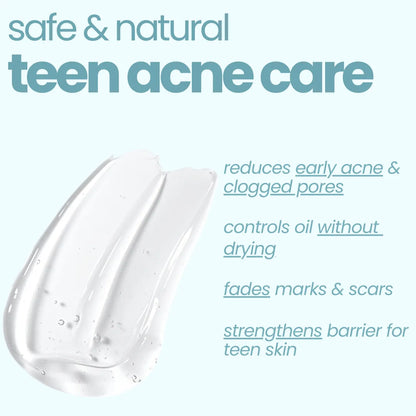 Acne Face Gel! (50g)