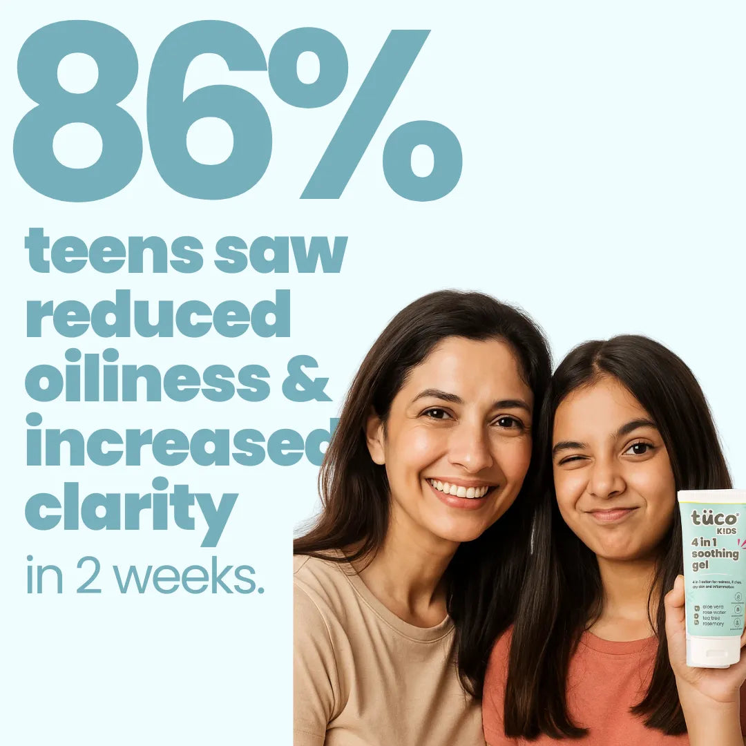 Acne Face Gel! (50g)