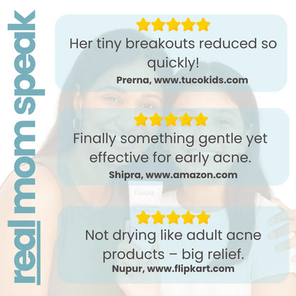 Acne Face Gel! (50g)