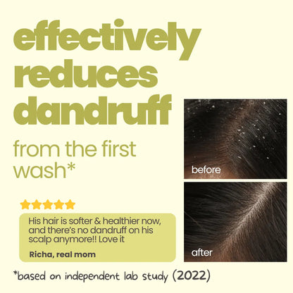 Flake Fighter Anti Dandruff Shampoo (100 ml)