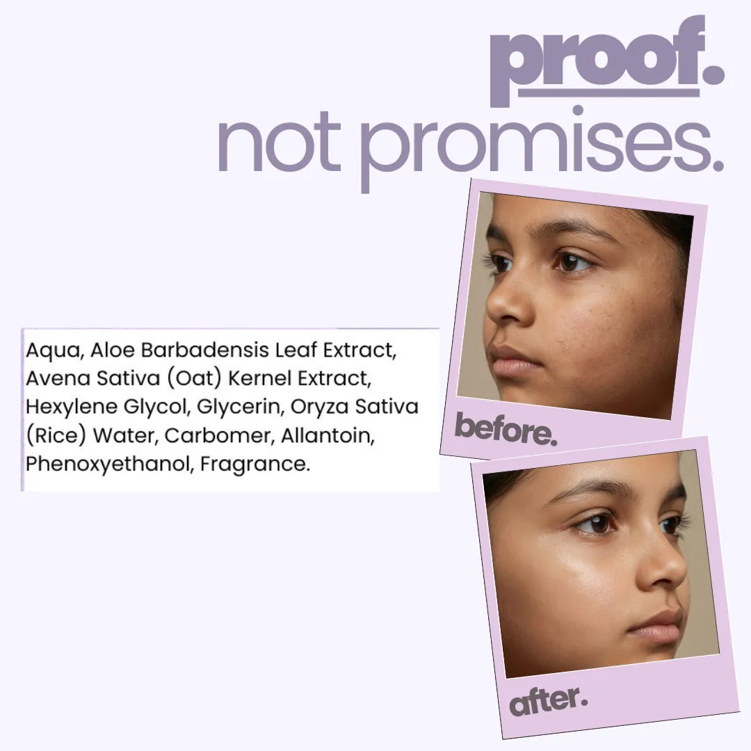 Oat & Rice Water Face Gel