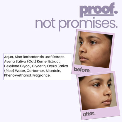 Oat & Rice Water Face Gel