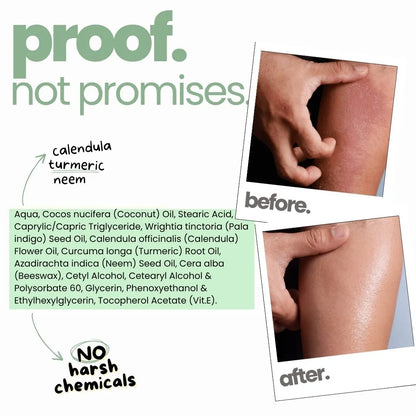 Very Dry Skin Cream (30g)