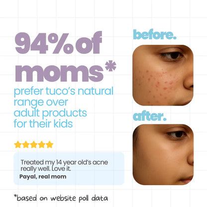 Teen Acne Kit: Acne Face Gel + Oily Skin Face Wash