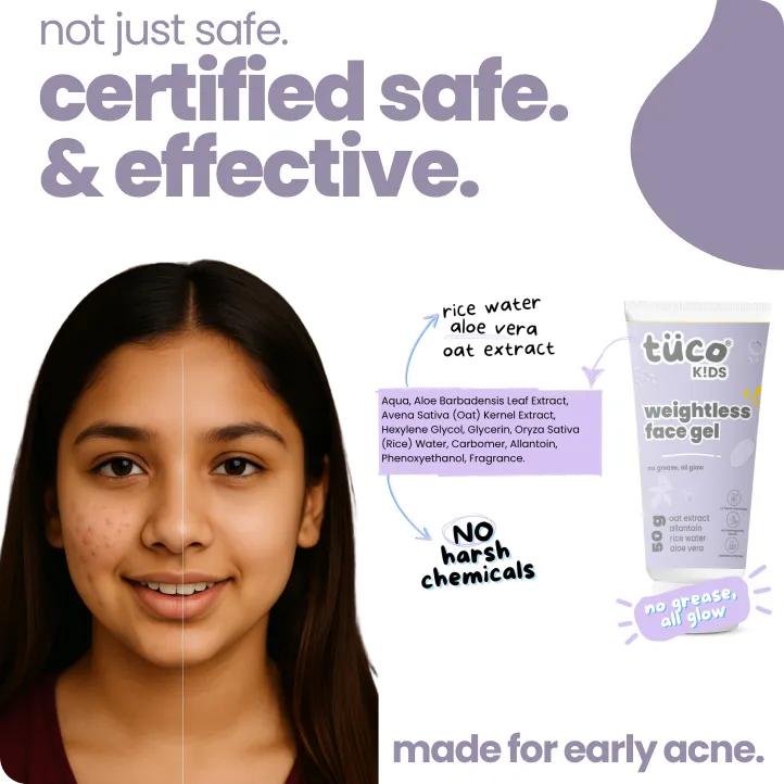 Teen Acne Gel for Kids