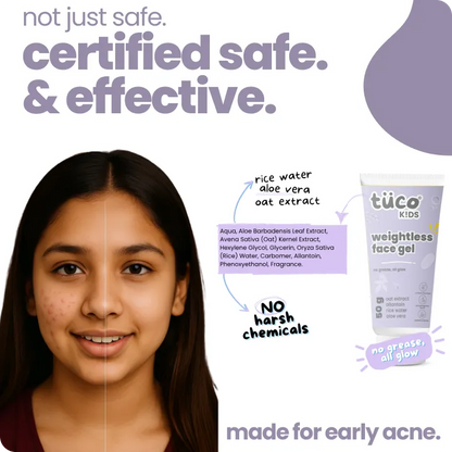 Teen Acne Gel for Kids