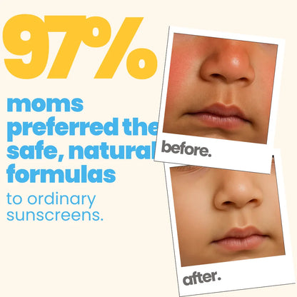 Complete Sun Protection Kit : Sun Lotion + Sunscreen (SPF 50)