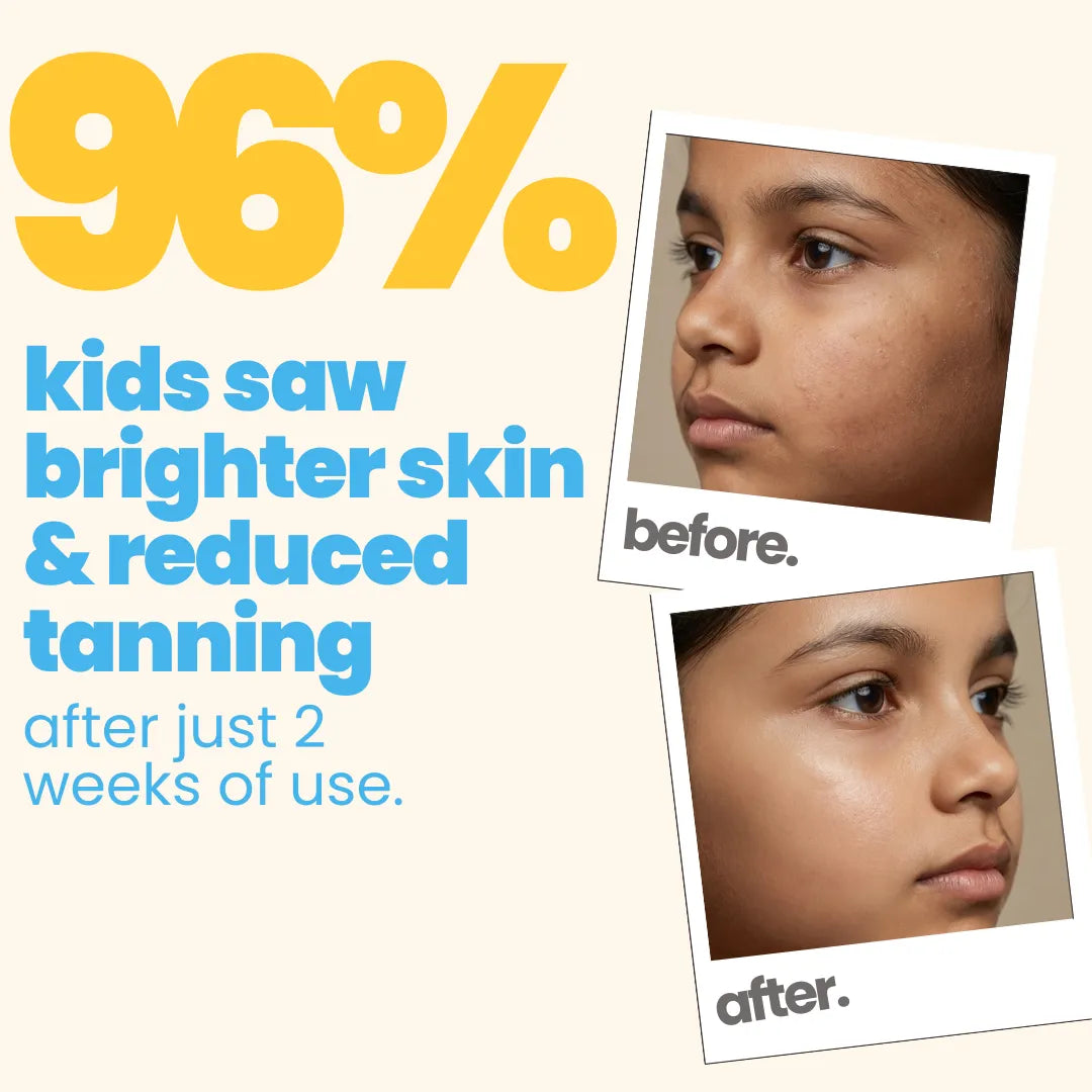Tuco Kids 3-in-1 Dull Skin Kit - 96% of kids saw brighter skin and reduced tanning after just 2 weeks of use, before and after results