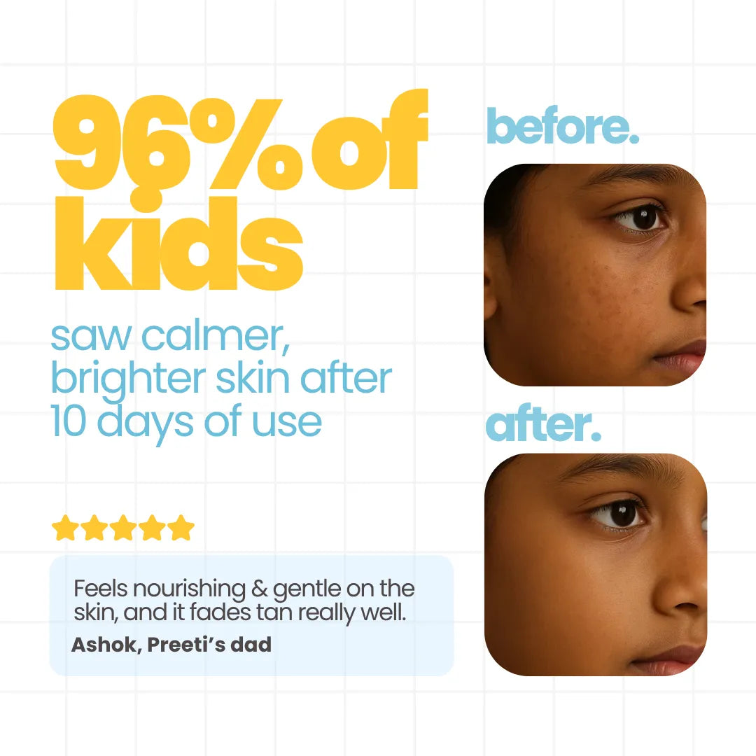 3-in-1 Dull Skin Skincare Kit — Gentle Daily Care for Kids | Tuco Kids