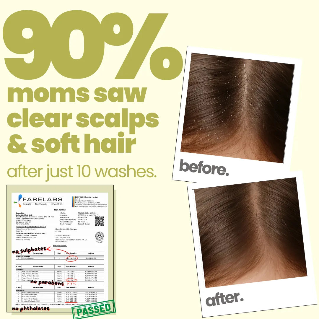 Before and after Tuco Kids Flake Fighter shampoo – 90% moms saw clear scalps and soft hair after 10 washes, lab tested no sulphates or parabens
