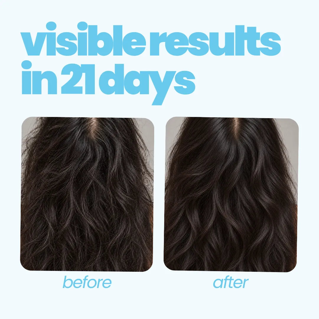 Scalp Rebalance Kit for Teens