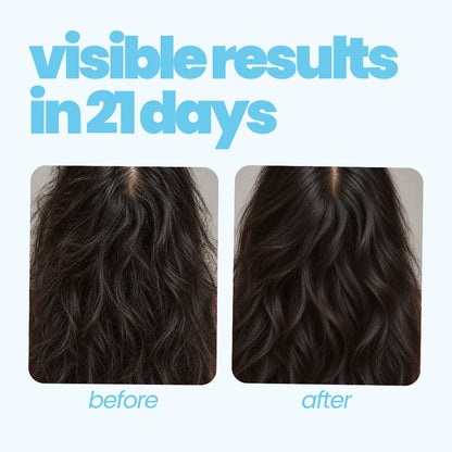Scalp Rebalance Kit for Teens