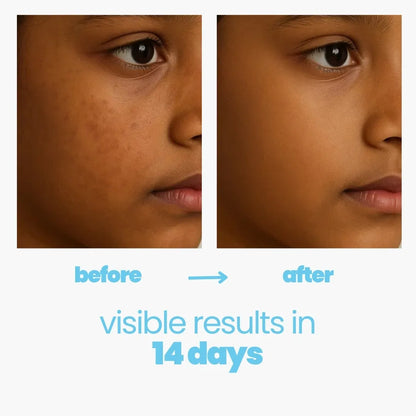 Bye Dull Skin Body Wash for Kids.