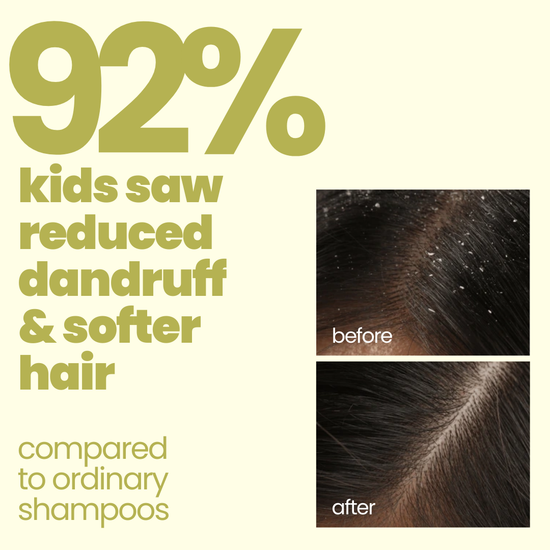 Flake Fighter Anti Dandruff Shampoo (100 ml)