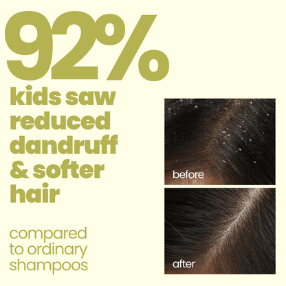 Flake Fighter Anti Dandruff Shampoo (100 ml)