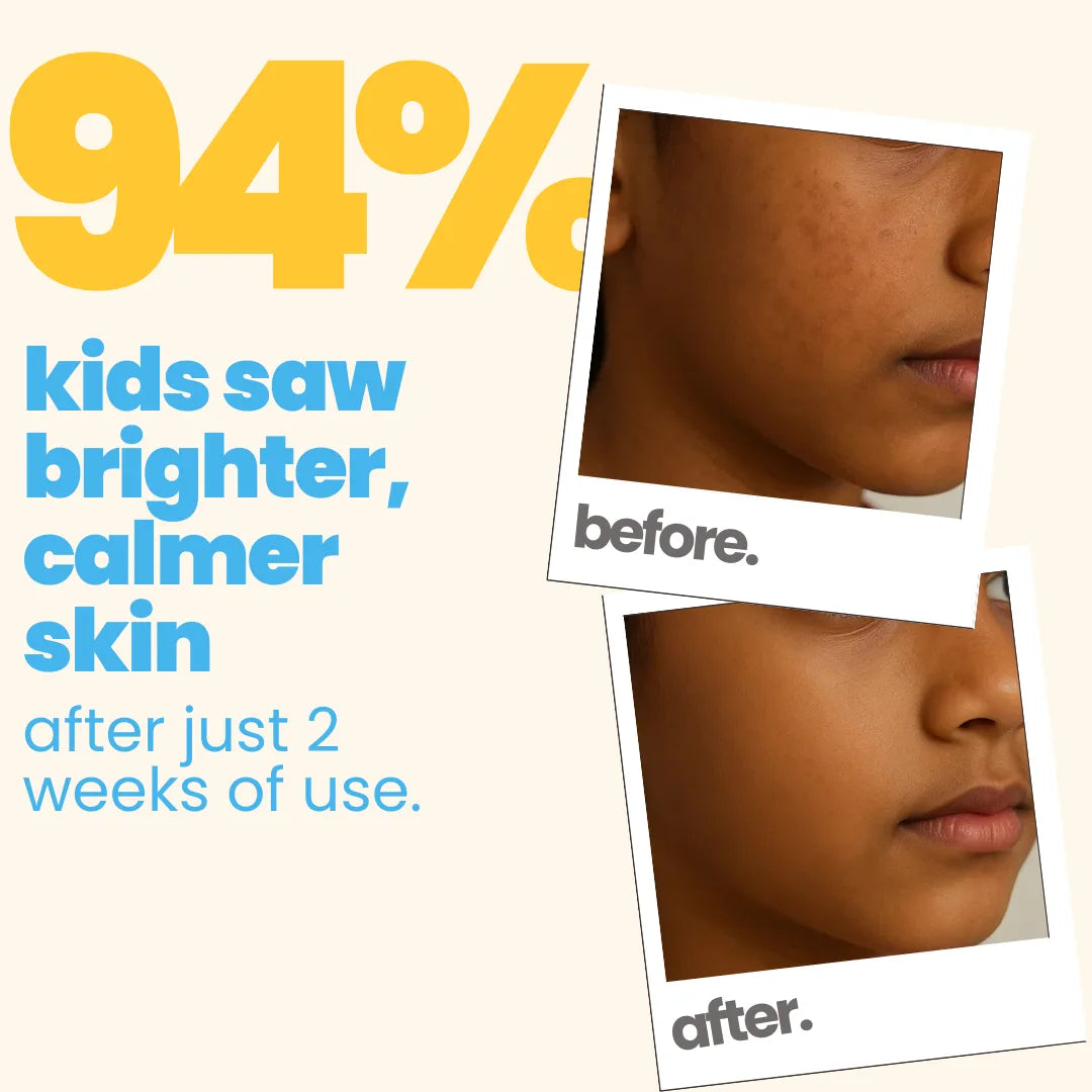 Sun Care Kit: Dull Skin Facewash + Gel Sunscreen SPF 50