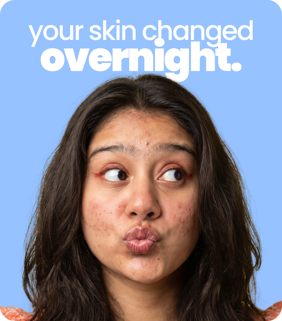 sensitiveskin