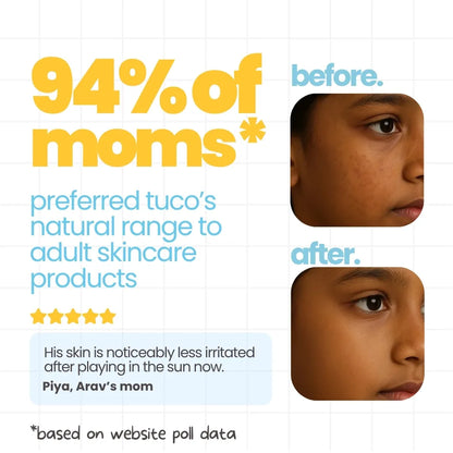 4-in-1 Dull Skin Kit for Kids: Face Wash + Soap + Sunscreen + Lotion — image 6 | Tuco Kids