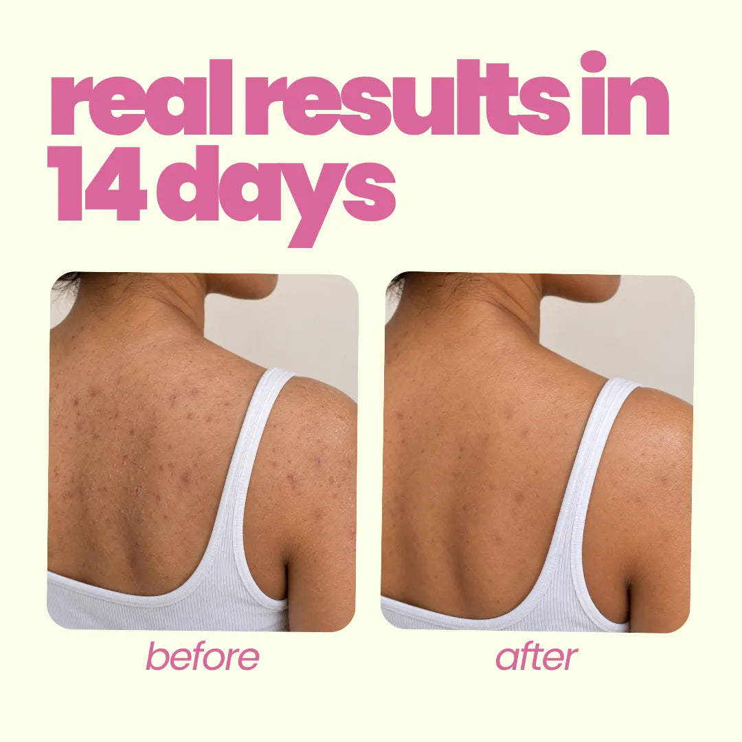 Body Care Kit for Teens