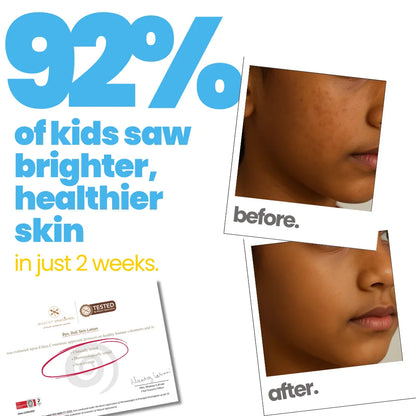 Bye, Dull Skin Body Lotion for Kids - 200 ml