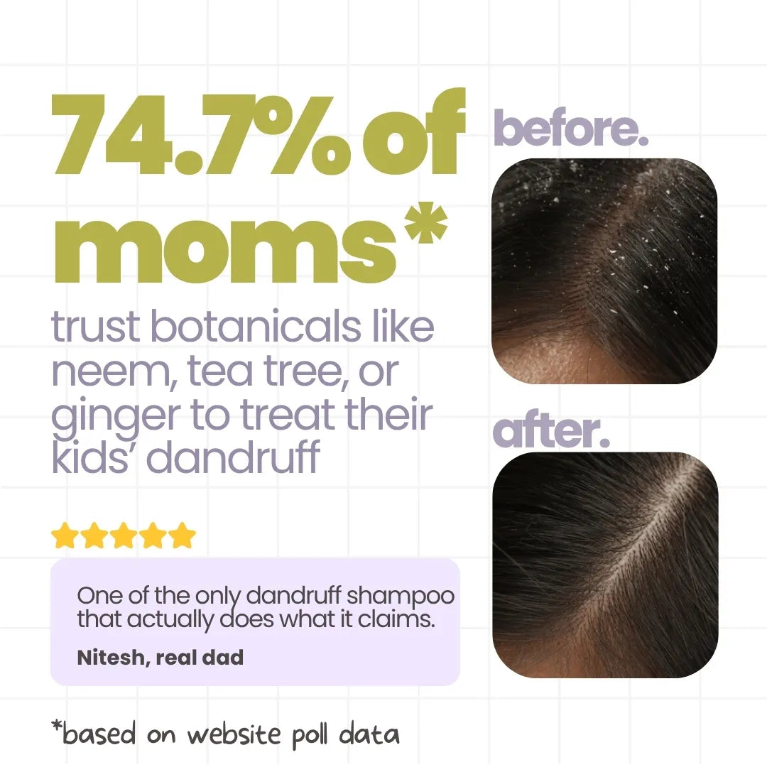 Flake Fighter Anti Dandruff Shampoo For Kids 200 ml