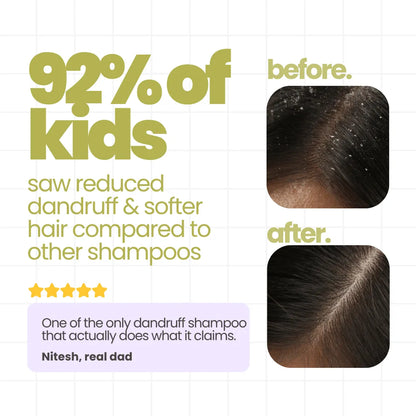 Flake Fighter Anti Dandruff Shampoo For Kids 200 ml