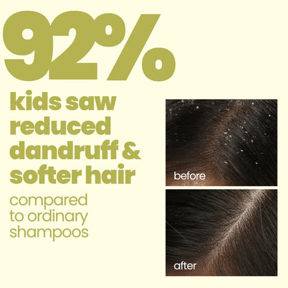 Flake Fighter Anti Dandruff Shampoo. (100ml) — how to use | Tuco Kids