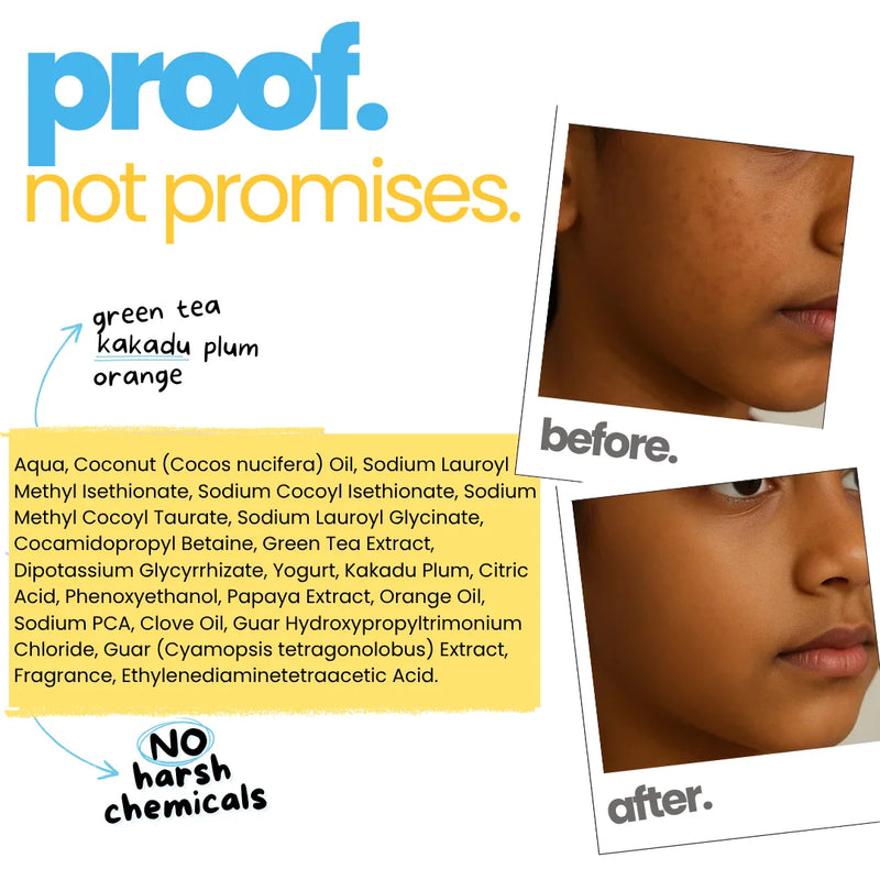 Bye, Dull Skin Wash
