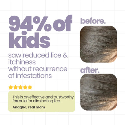 Anti Lice Shampoo for Kids - 100 ml