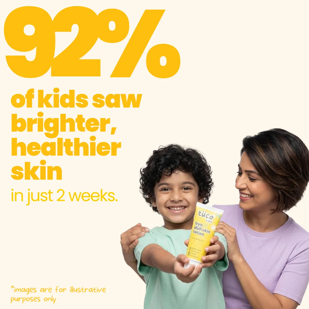 Bye, Dull Skin Body Lotion for Kids - (200 ml)