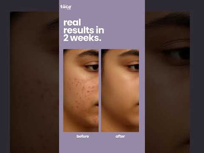 Teen Acne Gel for Kids