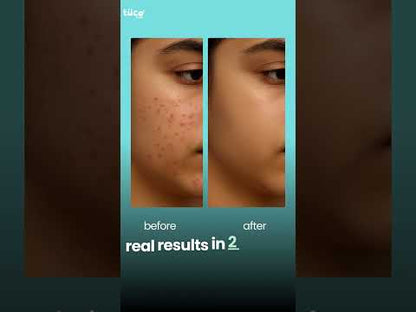 Oily Skin Face Wash (100ml)!