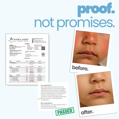 Proof not promises - Tuco Kids boys body wash Farelabs certified, before and after skin results for kids