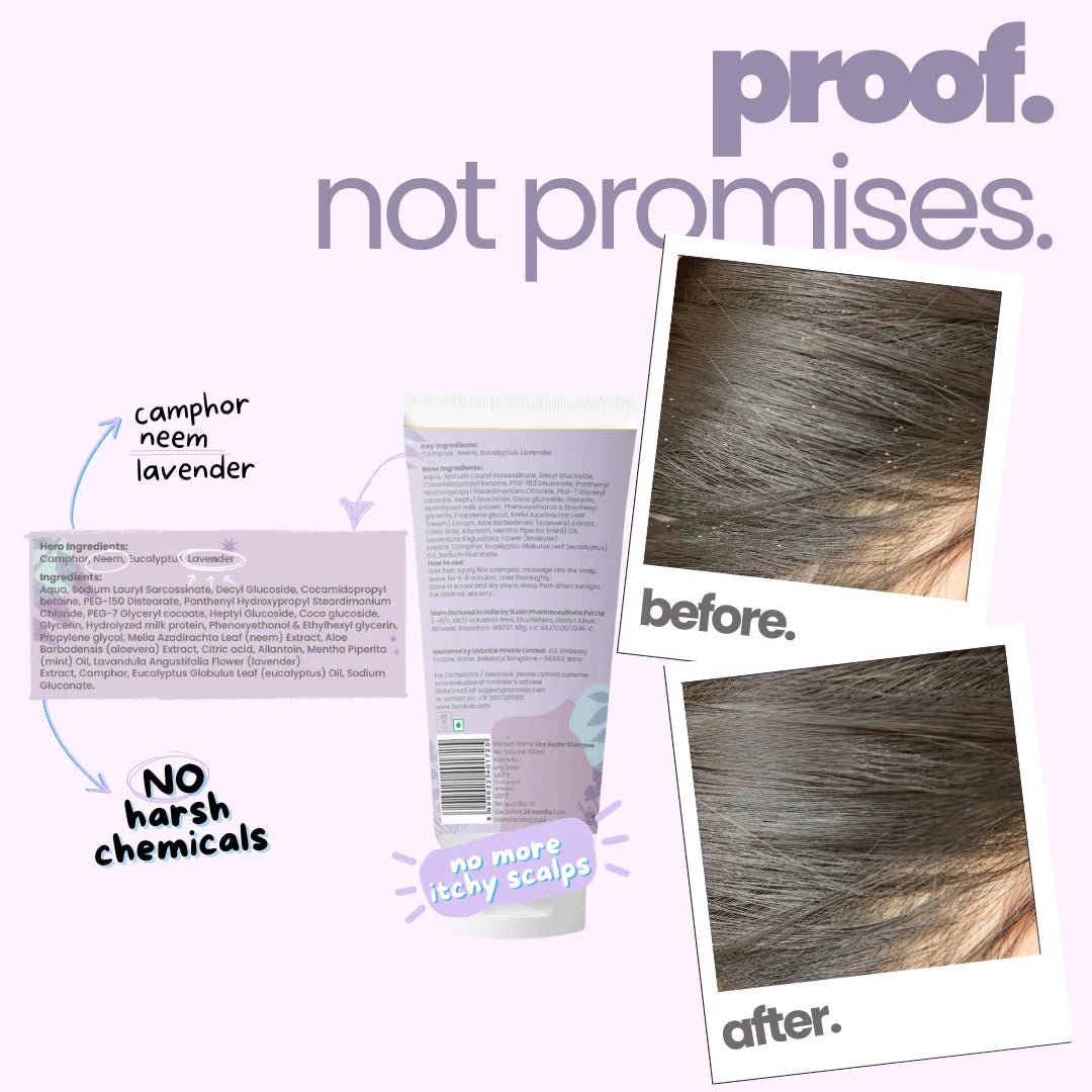 Proof not promises - Tuco Kids lice shampoo for kids before and after showing lice removed from kids hair