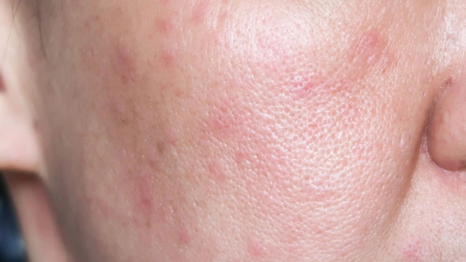 sensitive skin for kids