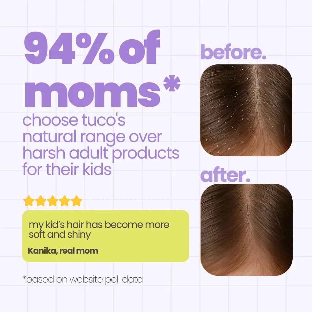 Ultimate Winter Dandruff Hair Pack — before and after results | Tuco Kids