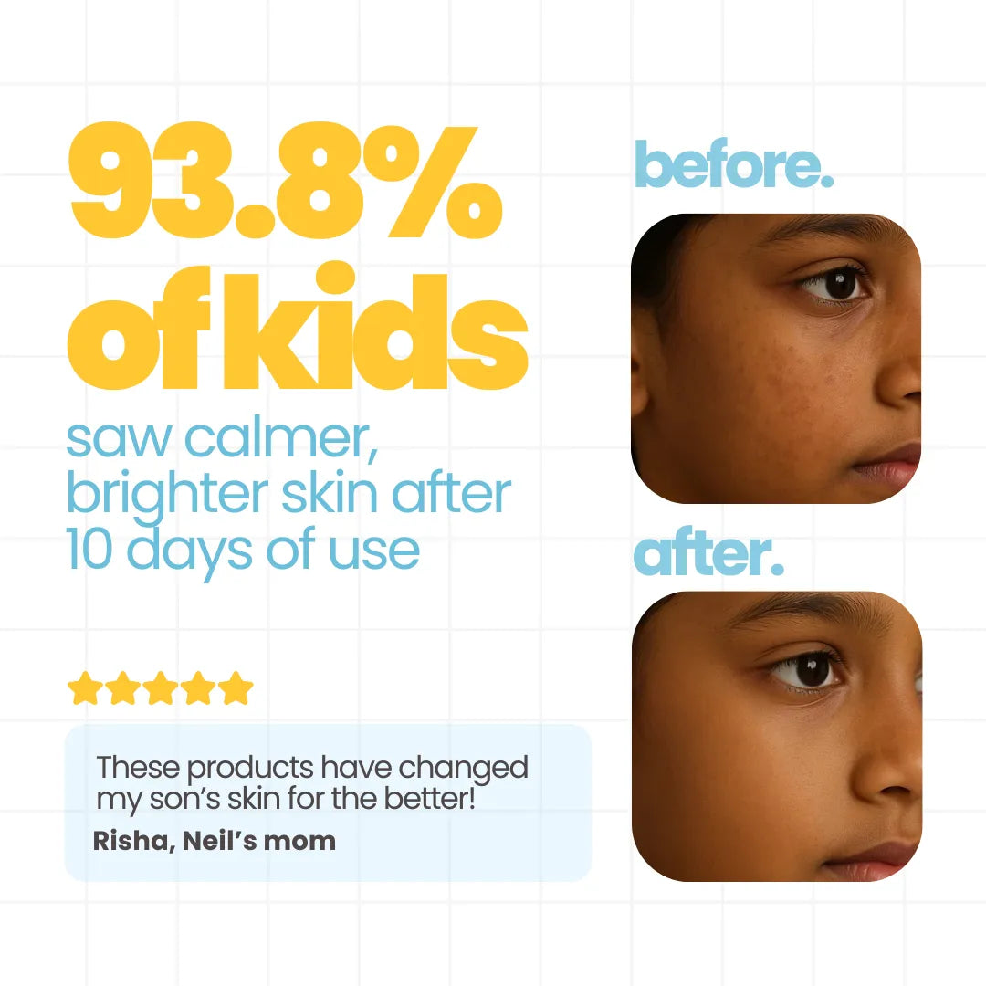 93.8 percent of kids saw calmer brighter skin after 10 days of using Tuco Kids Detan Kit — before and after results for sun tanned skin in children